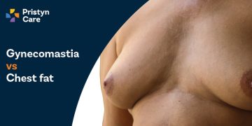 Gynaecomastia vs Chest Fat​