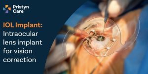 IOL Implant: Intraocular Lens Implant for Vision Correction