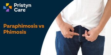 paraphimosis-vs-phimosis