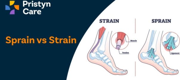 Sprain Vs Strain