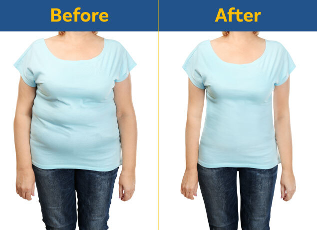 How to Tighten Loose Skin After Weight Loss Without Surgery