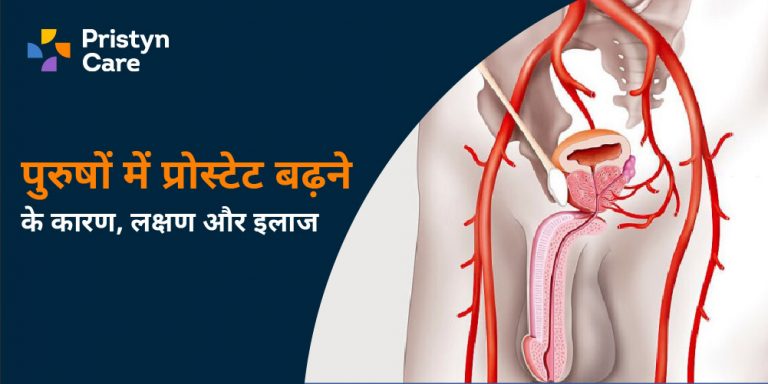 पुरुषों में प्रोस्टेट बढ़ने के कारण, लक्षण और इलाज