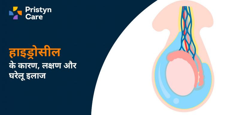 Hydrocele home treatment in hindi