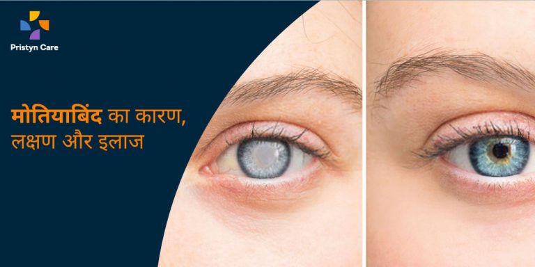 cataract-in-hindi