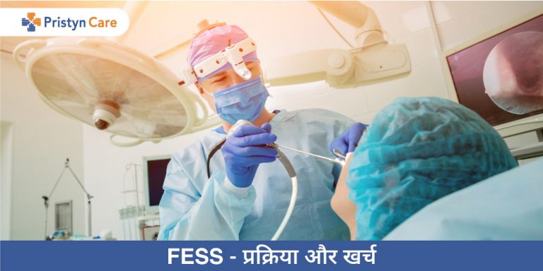 FESS in hindi