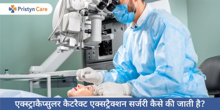 extracapsular-cataract-extraction-in-hindi