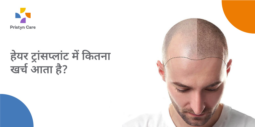 How Much Hair Transplant Cost in India