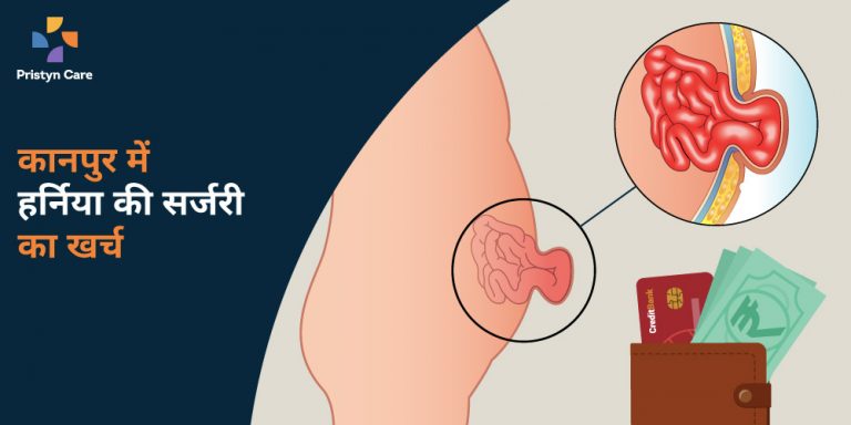 कानपुर-में-हर्निया-की-सर्जरी-का-खर्च