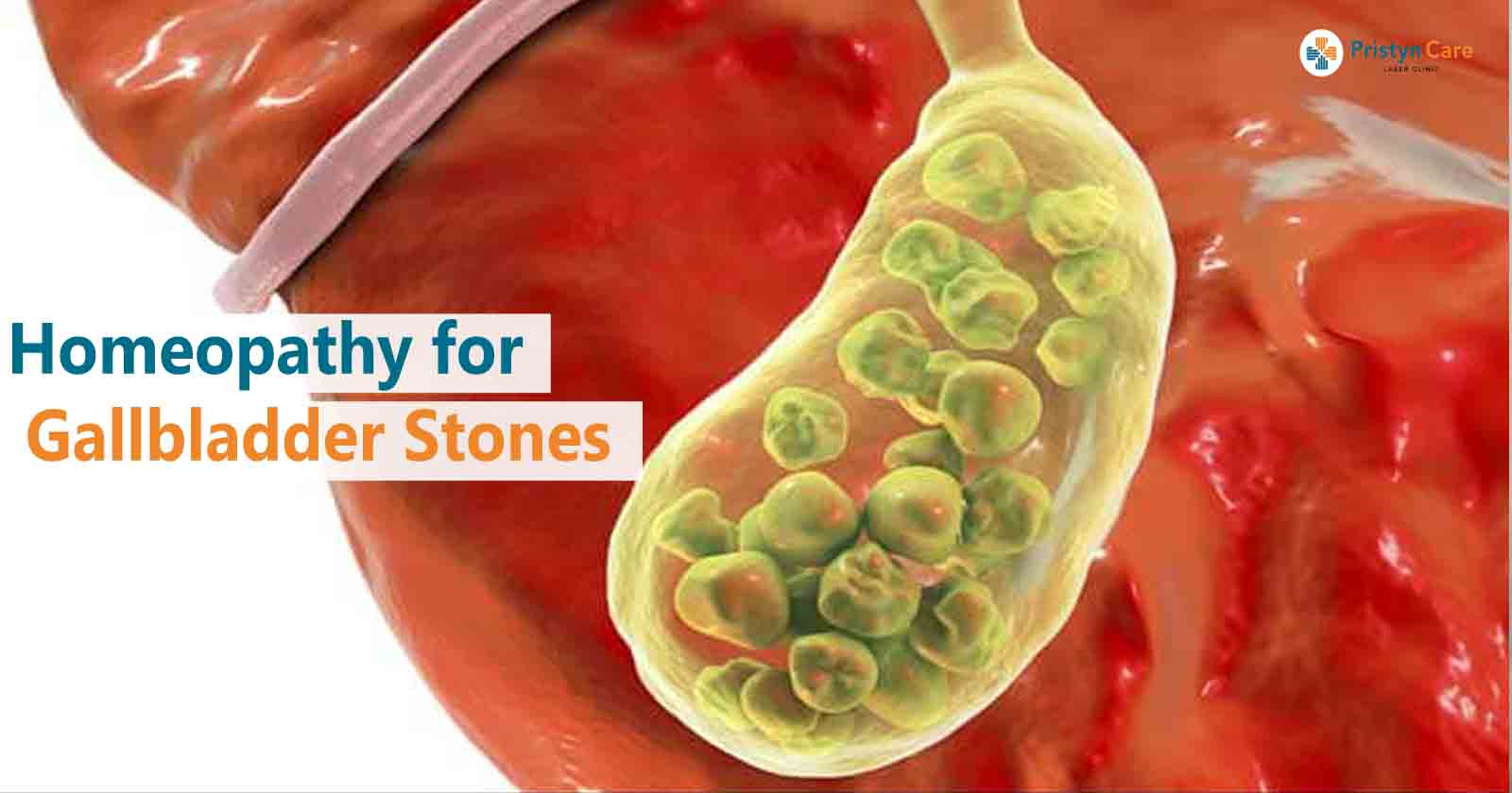 Homeopathy For Gallbladder Stones